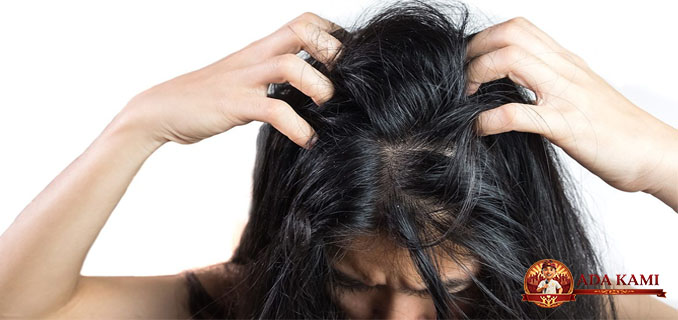 Ketombe Membandel Bisa Jadi Tanda Masalah Kesehatan Serius