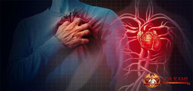 Mitos Terpatahkan Serangan Jantung Tak Pernah Terjadi Mendadak